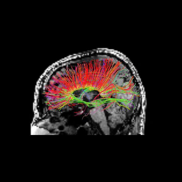 ../../_images/2ab57f30bf83f4a821a5762646322e9d9971286c80c7f0558b0d25078a032d2f.png