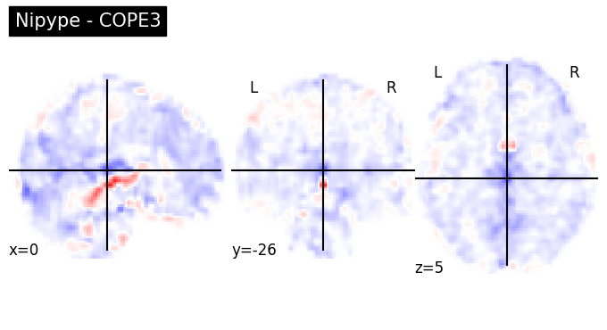 ../../_images/856c453baf6d5d96aef39a6fea31f2508b4f6867c52fea283321f7b416cd574c.png