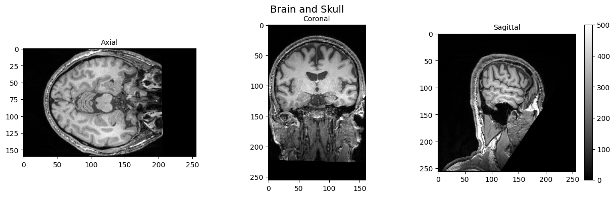 ../../_images/bdbf7af2fa1dbd35e2ae281822d741bcccd97f9be948993c04ca395ff2f2e5f3.png