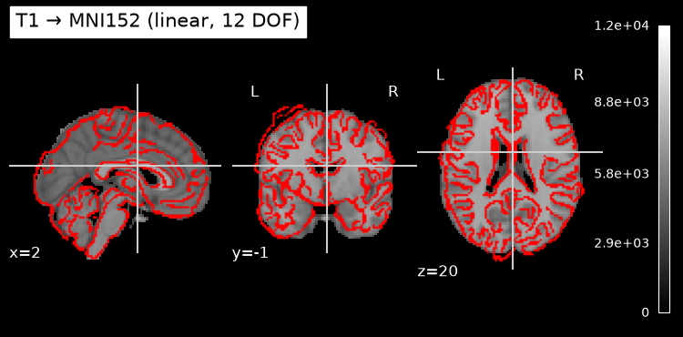 ../../_images/bfc033ca98276cebf2d3bcccf5c89cb1d7bc79cb3bf59b8ed8cc38a232f1aa2e.png