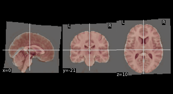 ../../_images/e621d3bb93f4d390cb2d1b30d22c02dad97f6ffa0ce35cc8598637dacd64db2b.png