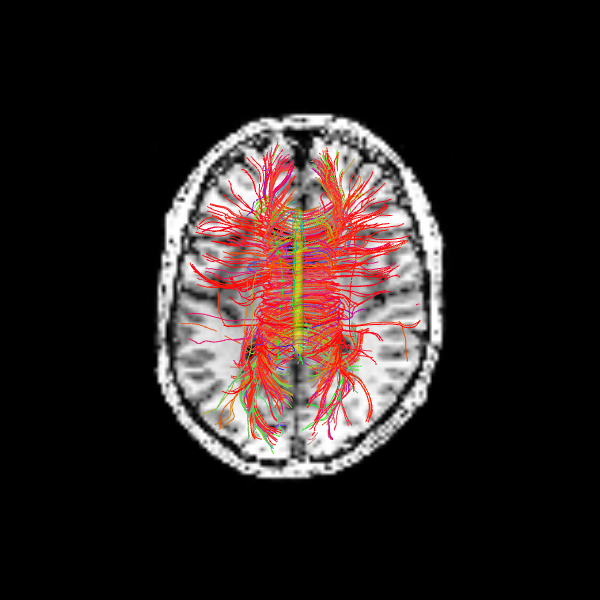 ../../_images/f7feea880fd13dda2fa89d65f3ae00e2ff95caa4c4d5790c95ce178f9484944b.png