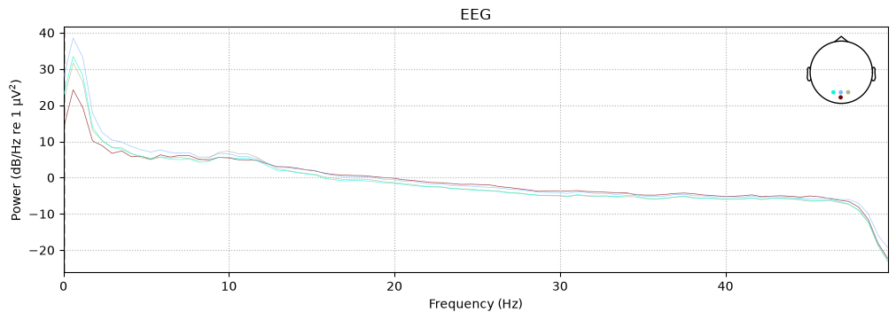 <MNELineFigure size 1000x350 with 2 Axes>