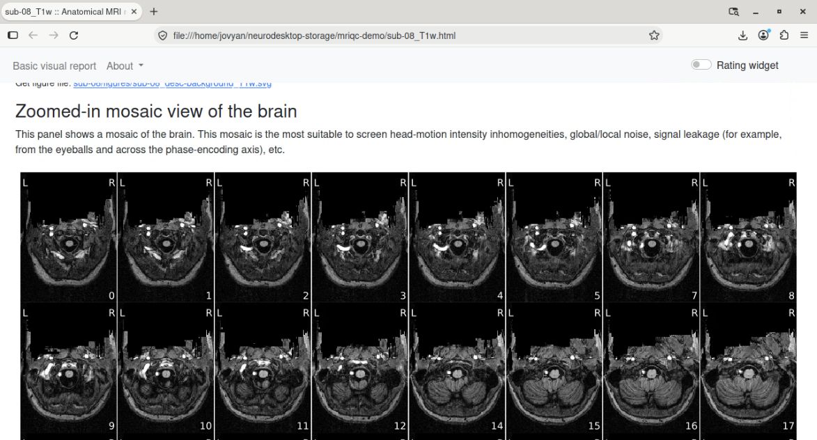 The anatomical mosaic section in the same clean Firefox window