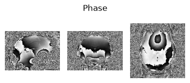 <Figure size 400x500 with 3 Axes>