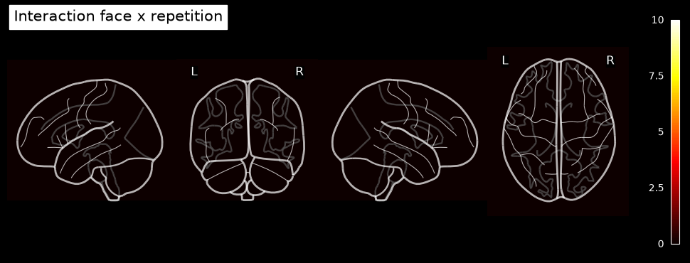 <Figure size 950x350 with 6 Axes>