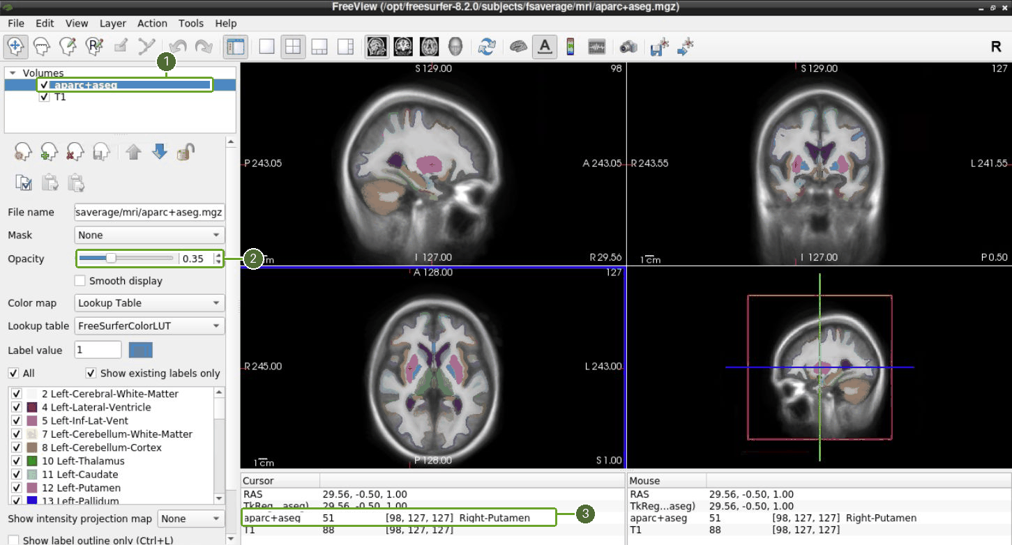 Toggle the segmentation, adjust its opacity and read the clicked structure name