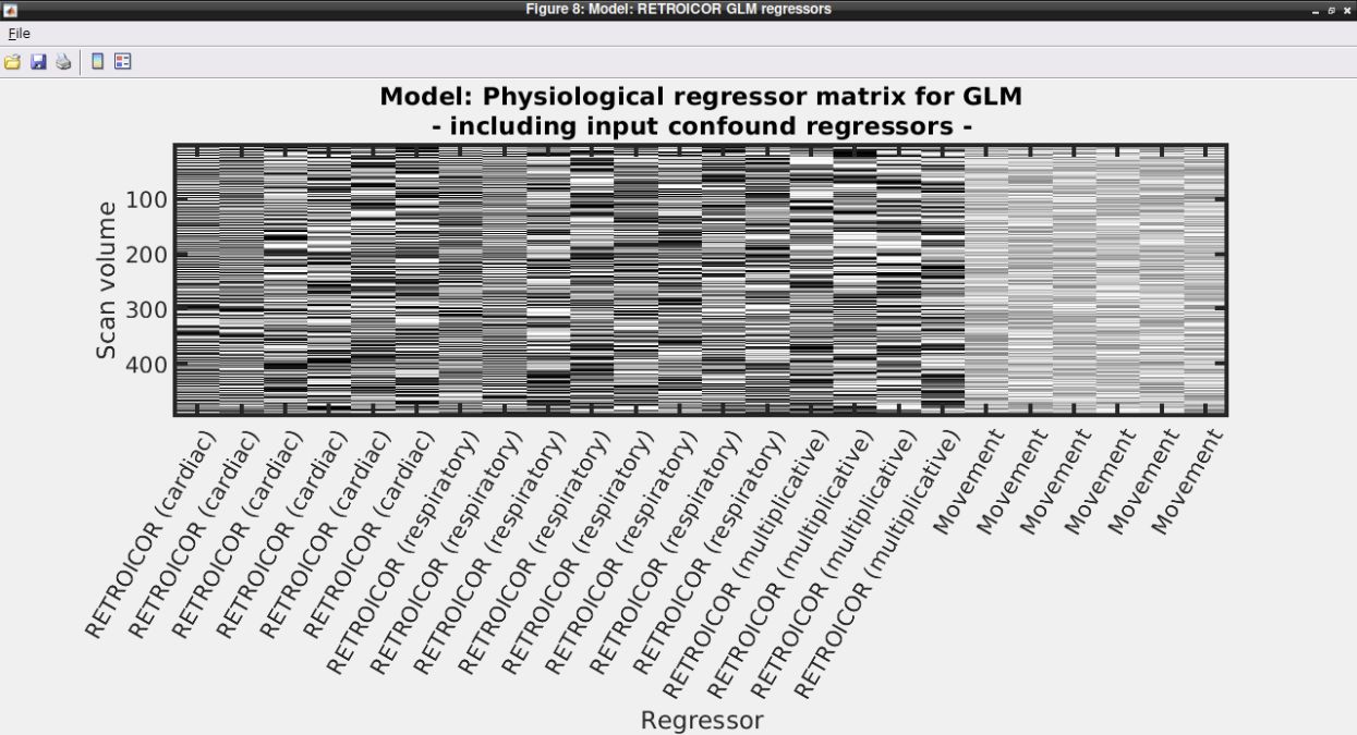 PhysIO nuisance regressor matrix from the Philips ECG3T example