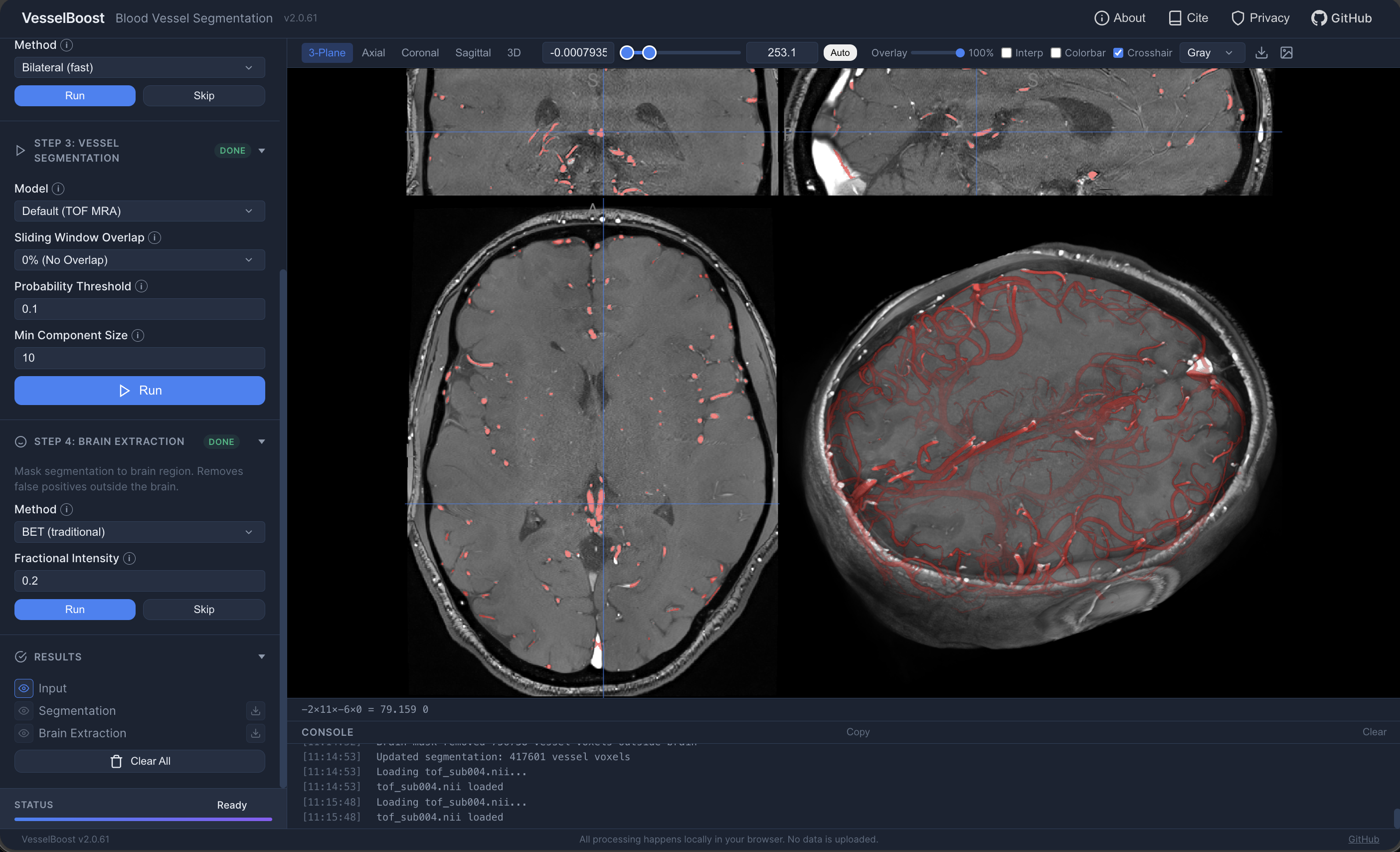 VesselBoost screenshot