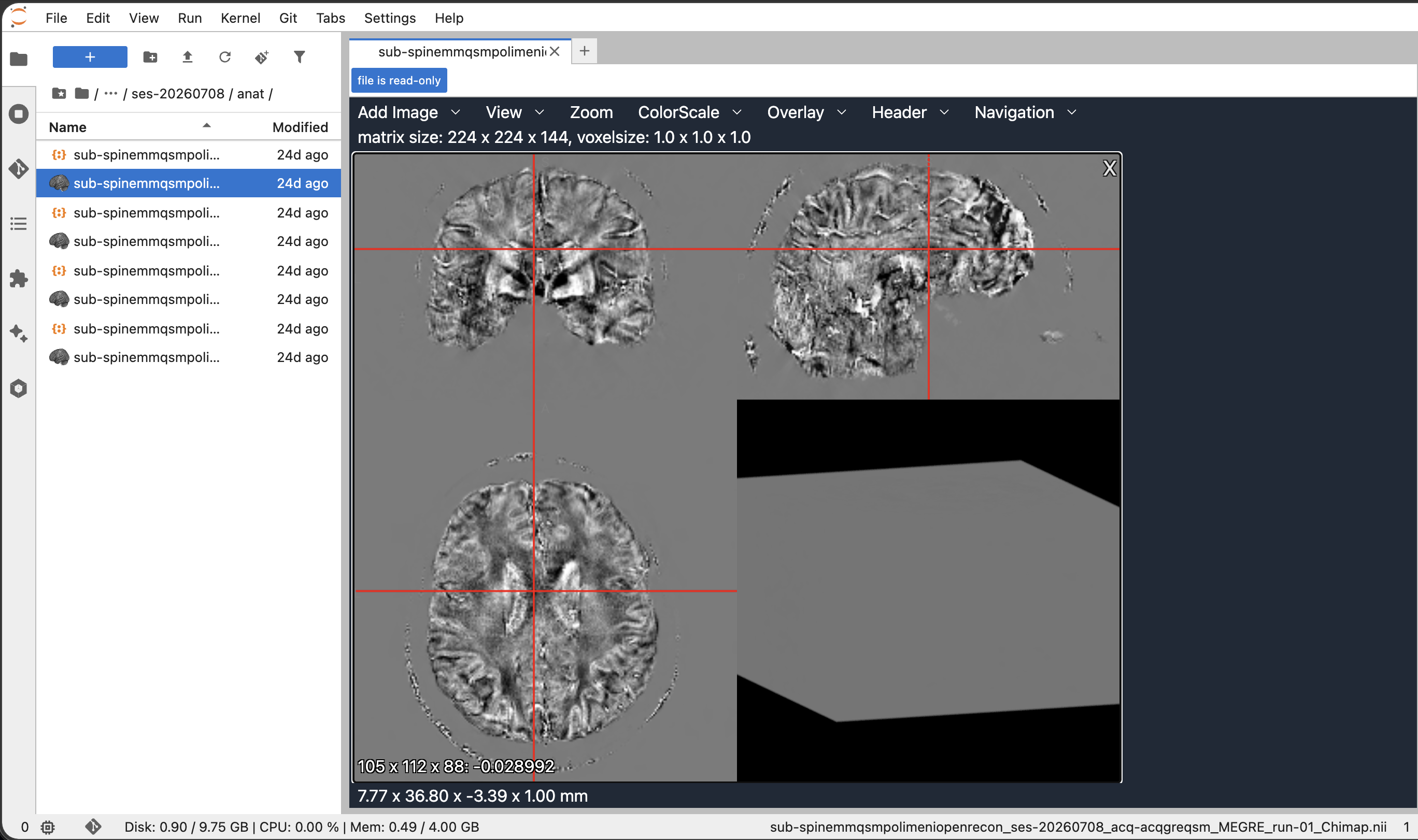 Neurodesk JupyterLab session showing mounted XNAT data and an interactive NIfTI image viewer